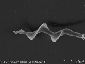 SEM image of sperm cell head from a bluethroat (Luscinia svecica svecica). Photo: Hanna N. Støstad.